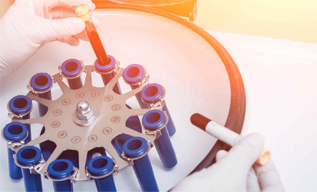 高濃度PRPが肌細胞を再生に導く