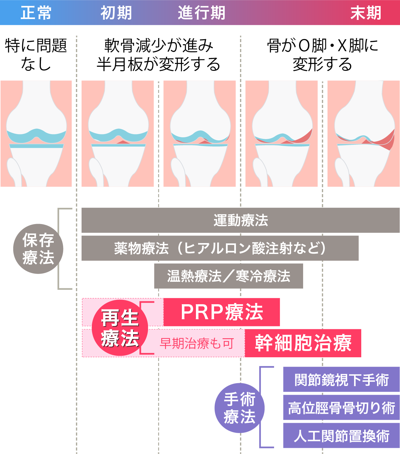 関節症の進行度の推移