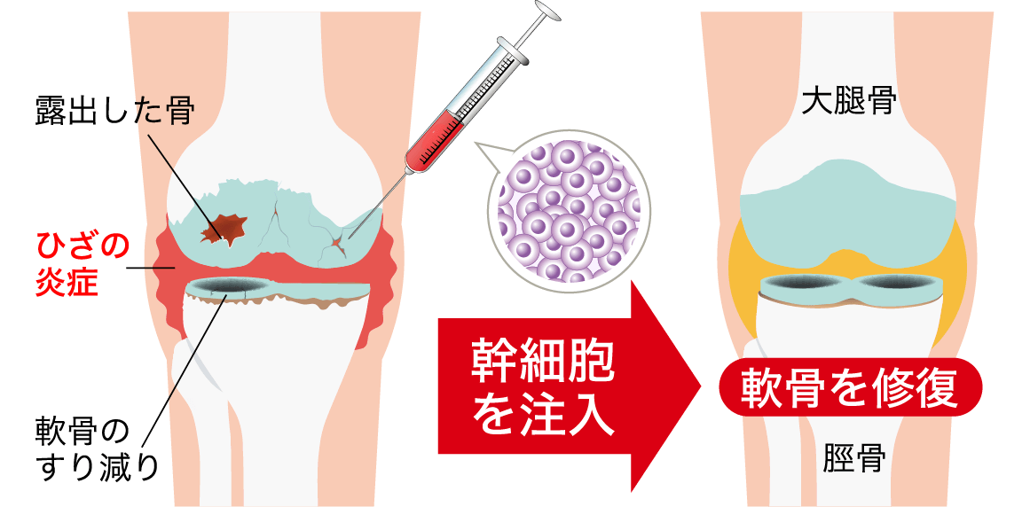 痛みの原因に対して根本治療