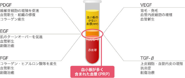 PRP（多血小板血漿）とは