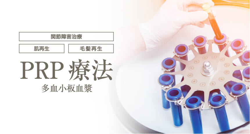 PRP療法